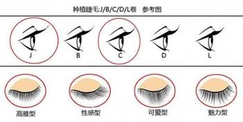 屈光不正最佳治疗方法