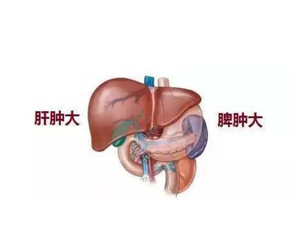 肝硬化是什么引起的