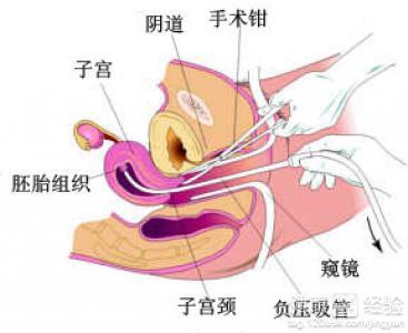 做完人流多久可以再怀孕,关于人流后的恢复时间与再次怀孕的稳定设计解析,灵活设计解析方案_VR版48.25.62