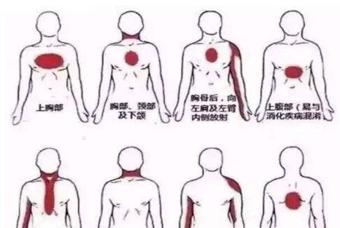 儿保院医生突然死亡