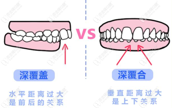 一深一浅是来月经先兆图片